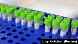 În ultimele 24 de ore au fost făcute 4.630 de teste RT-PCR și 11.838 teste rapide antigen.