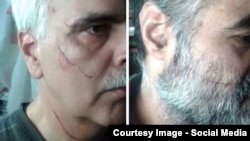 اثر چاقو بر صورت سعید مدنی (چپ) و سعید رضوی فقیه (راست)